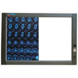 Negatoscopio doble LED MP-ZG2 (VENTA SOBRE PEDID0)