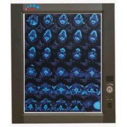 Negatoscopio sencillo LED MP-ZG1 (SOBRE PEDIDO)