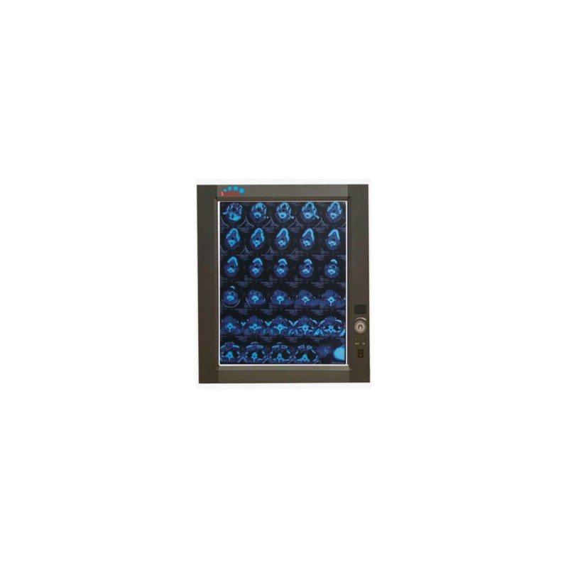 Negatoscopio sencillo LED MP-ZG1 (SOBRE PEDIDO)