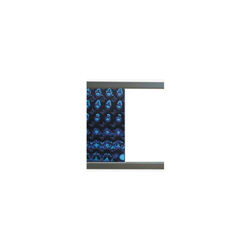 Negatoscopio doble LED MP-ZG2 (VENTA SOBRE PEDID0)